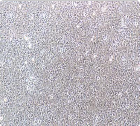 HBL-100 人整合SV40基因的乳腺上皮细胞传代/复苏技巧 