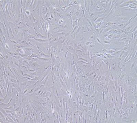 SJSA-1 人骨肉瘤细胞传代/复苏操作 