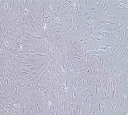 SW-1353 人骨肉瘤细胞传代/复苏操作 