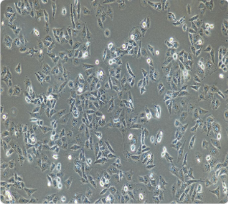 MDA-MB-231 人乳腺癌细胞传代/复苏操作 