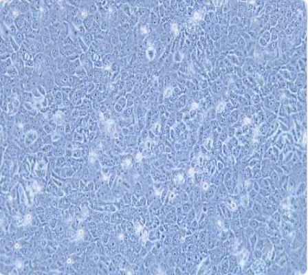 HCC-94 人子宫鳞癌细胞(高分化)传代/复苏技巧 