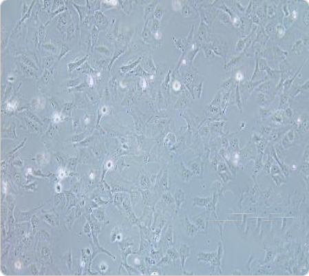 HCC38 乳腺导管癌细胞传代/复苏步骤 