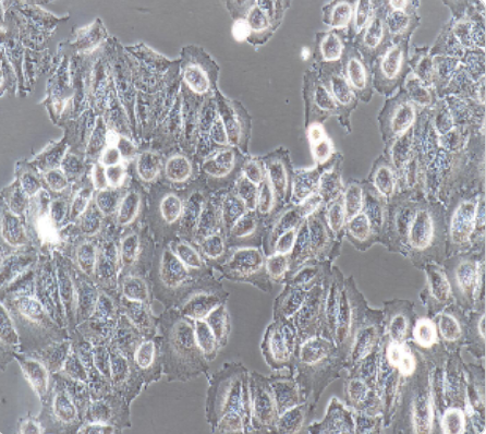 HeLa 人宫颈癌细胞传代/复苏技巧 