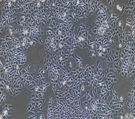HO-8910PM 人高转移卵巢癌细胞传代/复苏技巧 