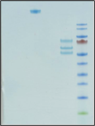 enzymeresearch FIB 3现货——上海起发 