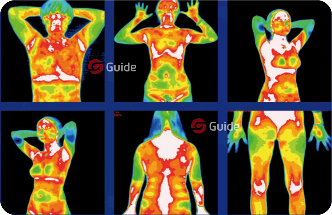 乳腺癌早期筛查 | 红外热像仪在医疗诊断中的应用 